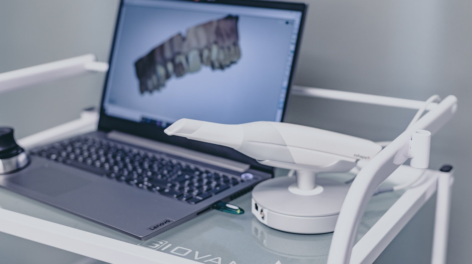 Предимства на дигитализирания работен процес в денталната медицина