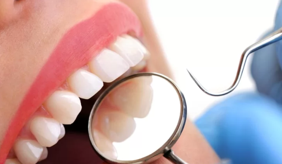 Защо трябва да почиствате зъбен камък и какви са ползите от това?
