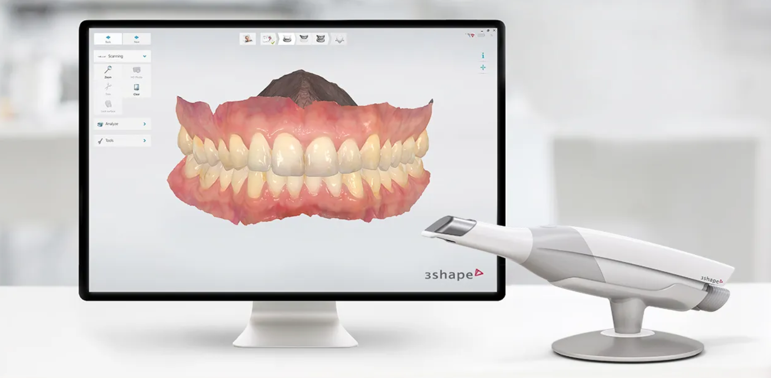 Предимства на дигиталния отпечатък и 3D сканирането